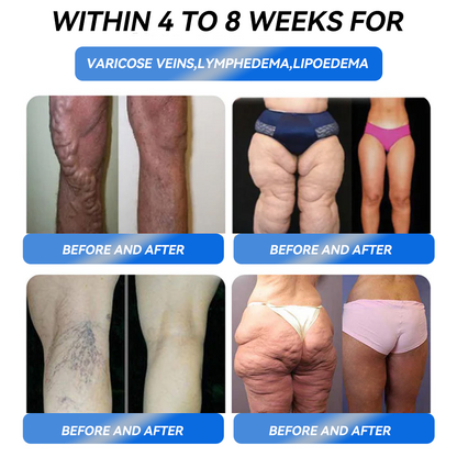 【Influencer's Pick】IFMAGIC® GLP-1 Pro Weight Loss Oral Solution  7 days visible effect, no side effects, suitable for all age groups