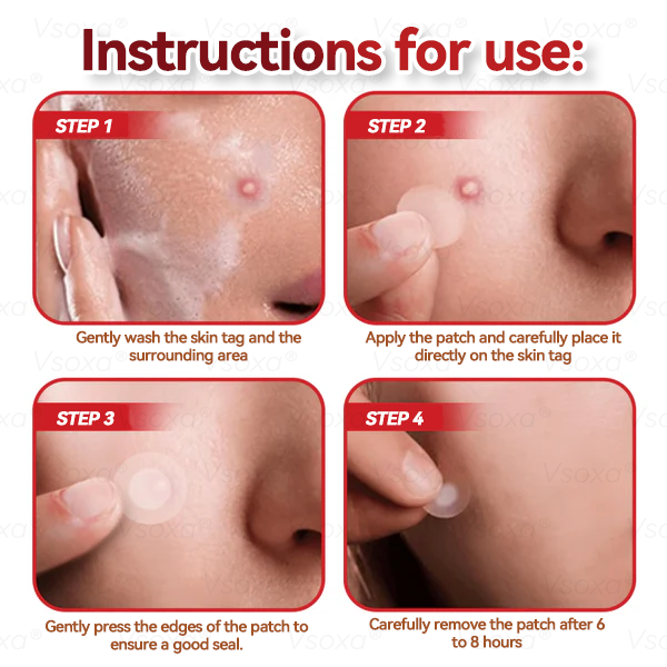 CZTICLE® 💧Microneedles Botanical Skin Tags Solution Patches - Made in the USA👩‍⚕️