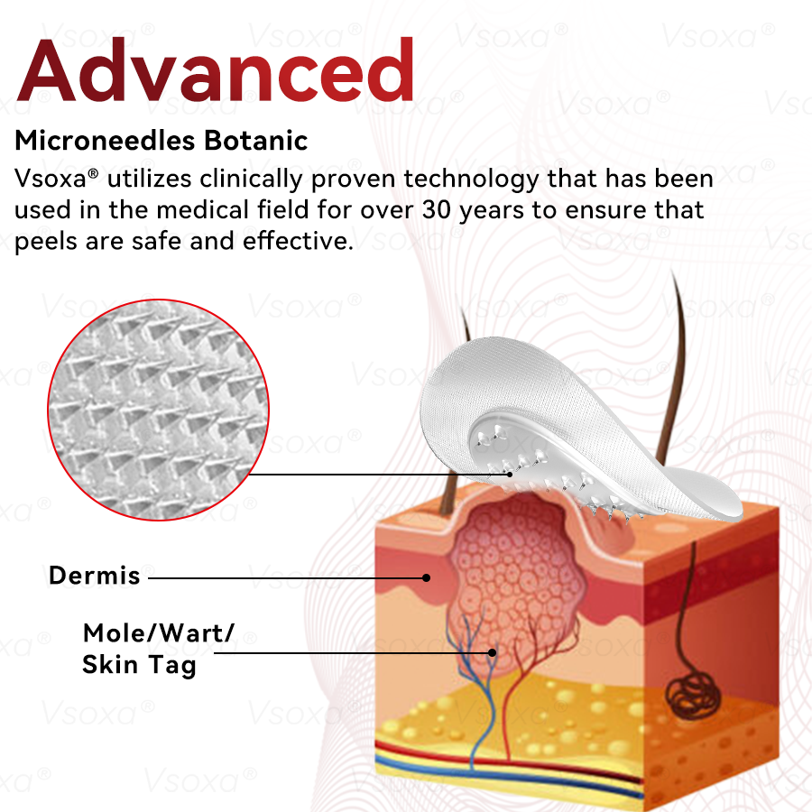 CZTICLE® 💧Microneedles Botanical Skin Tags Solution Patches - Made in the USA👩‍⚕️